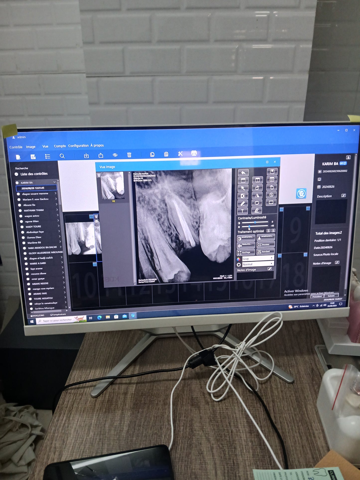 Dental X-Ray with RVG sensor