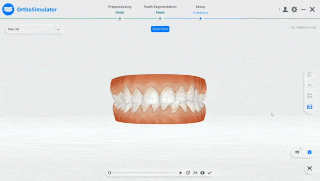 (Copie) wireless dental 3D scanner, shining 3D wireless, oral scan