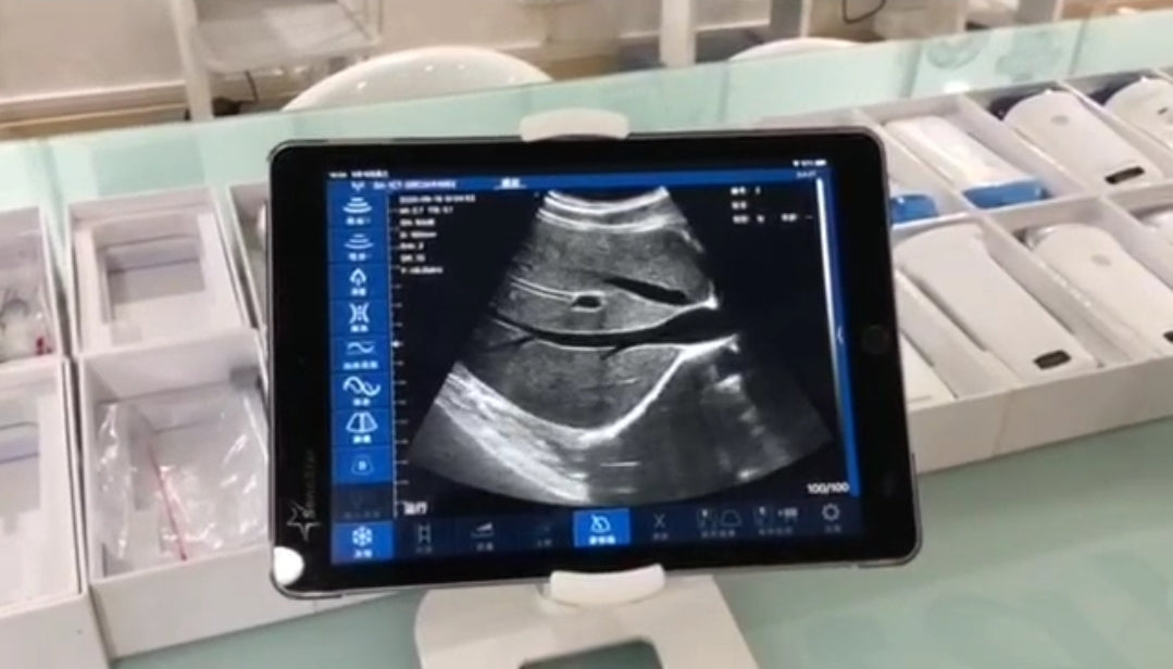 This sytle also is 3 in 1, and the Probe element:128
Display mode: B, B/M, Color doppler version with B+Color, B+PDI, B+PW. This style can check cardiac effect. 3 in 1: Convex+Cardiac +Linear. Ultra portable ecograph