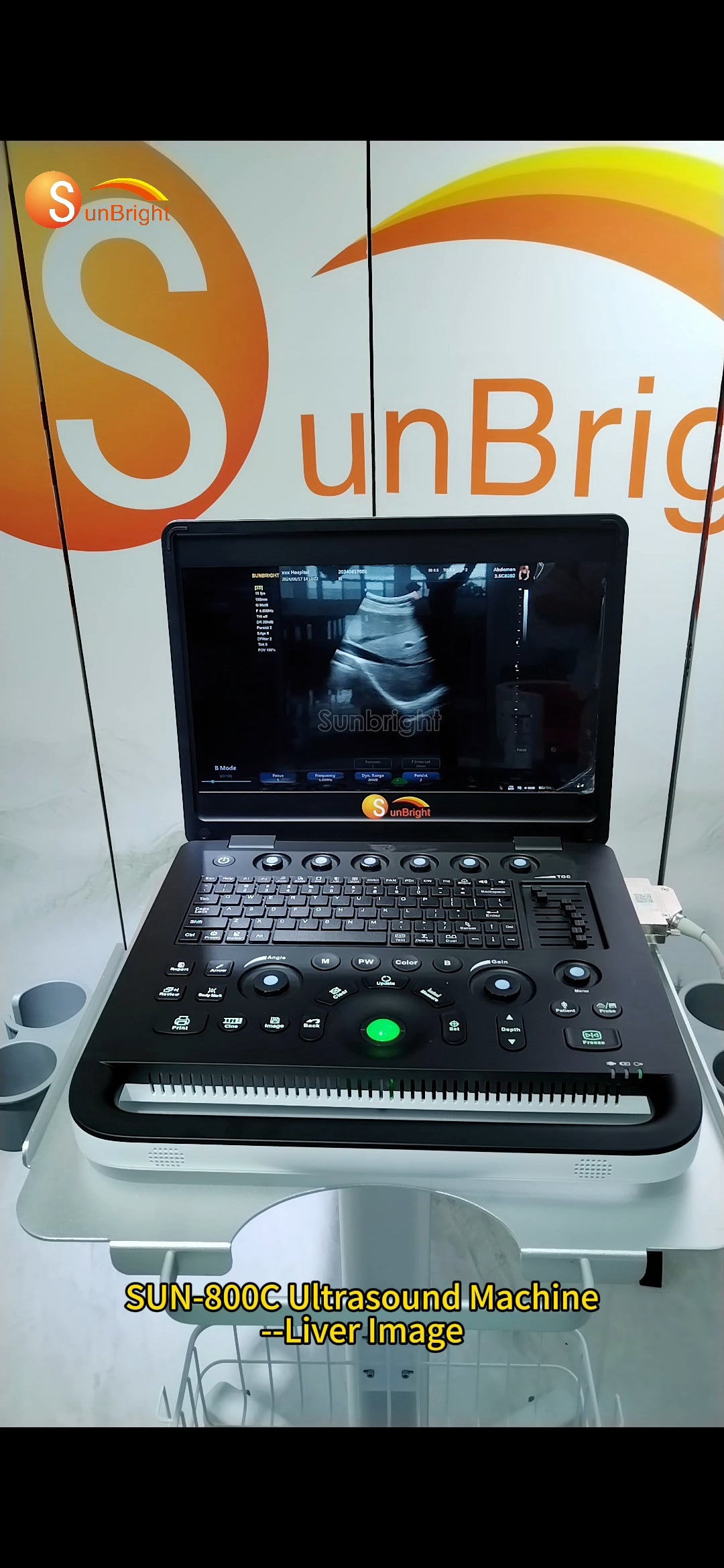 Laptop PW ultrasound SUN-800C:
for one main unit with one convex probe+one inbuilt battery+2 probe connector ports