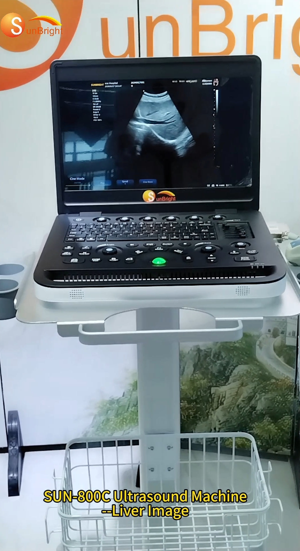 Laptop PW ultrasound SUN-800C:
for one main unit with one convex probe+one inbuilt battery+2 probe connector ports