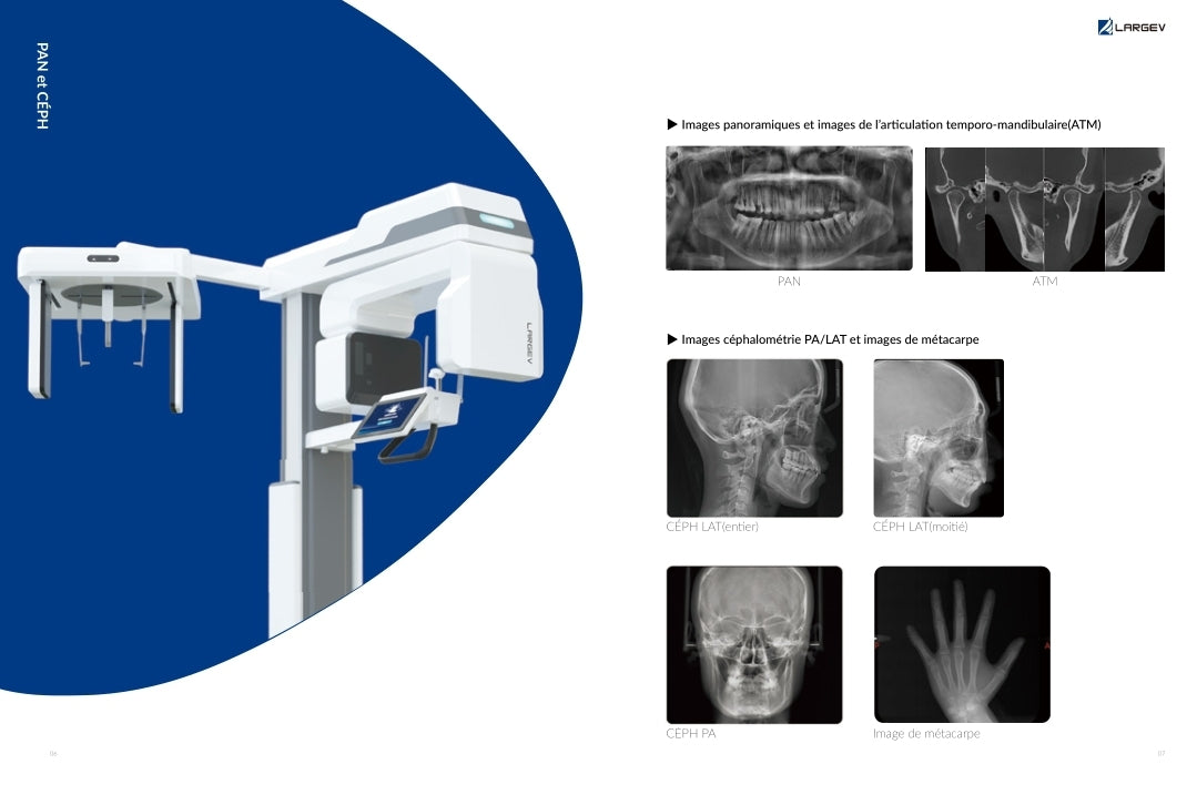 Smart3D X intelligent CBCT with flexible FOVS both 2D and 3D mode CBCT panoramic and cephalometric