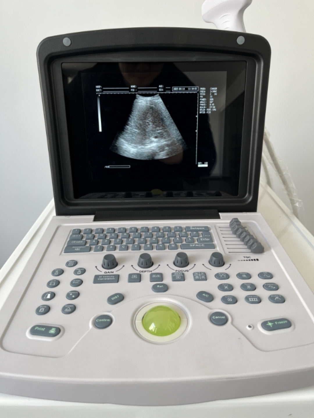 ##ecographe ##12inch BW ultrasound machine . With convex probe and batterie