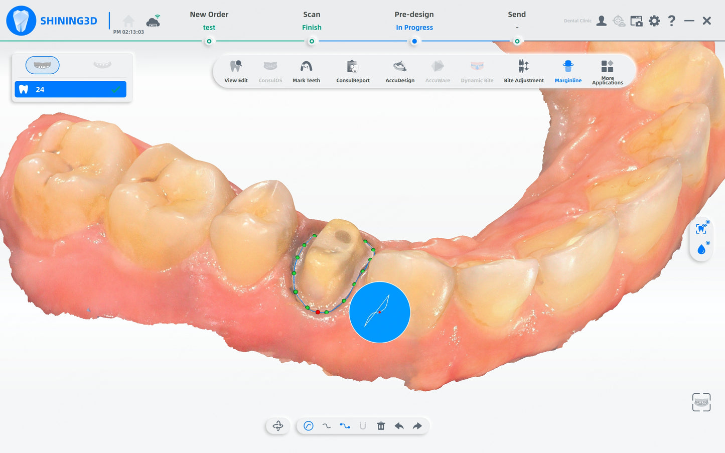 Shining 3D dental AoralScan L