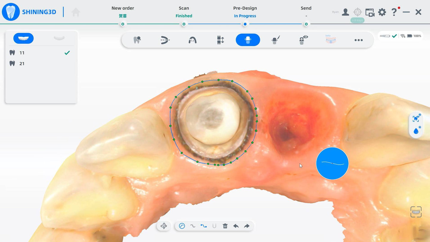 (Copie) wireless dental 3D scanner, shining 3D wireless, oral scan