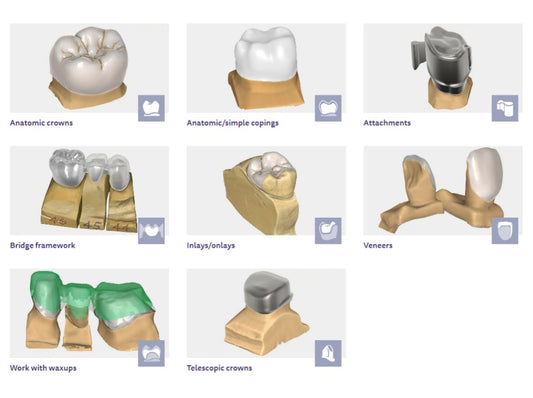 Exocad dental  core  version