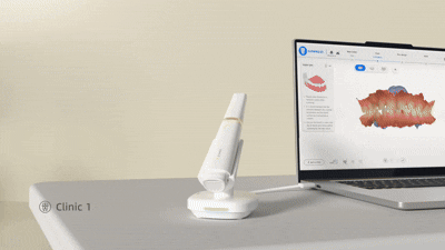 IPG intraoral  photogrametrie  shining 3D dental scanner.  AoralScan elite wireless