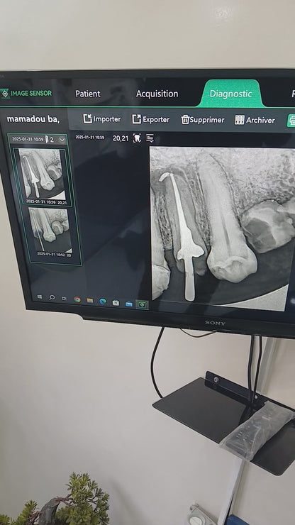 Dental RVG SENSOR  XV SENSOR