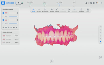 Shining 3D dental Aoralscan ELF, DIGITAL SCANNER,  dental  SCANNER