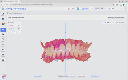 Shining 3D dental Aoralscan ELF, DIGITAL SCANNER,  dental  SCANNER