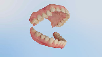 Shining 3D dental Aoralscan ELF, DIGITAL SCANNER,  dental  SCANNER