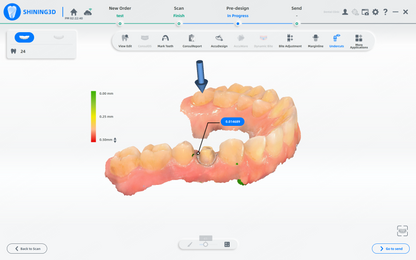 Shining 3D dental AoralScan L