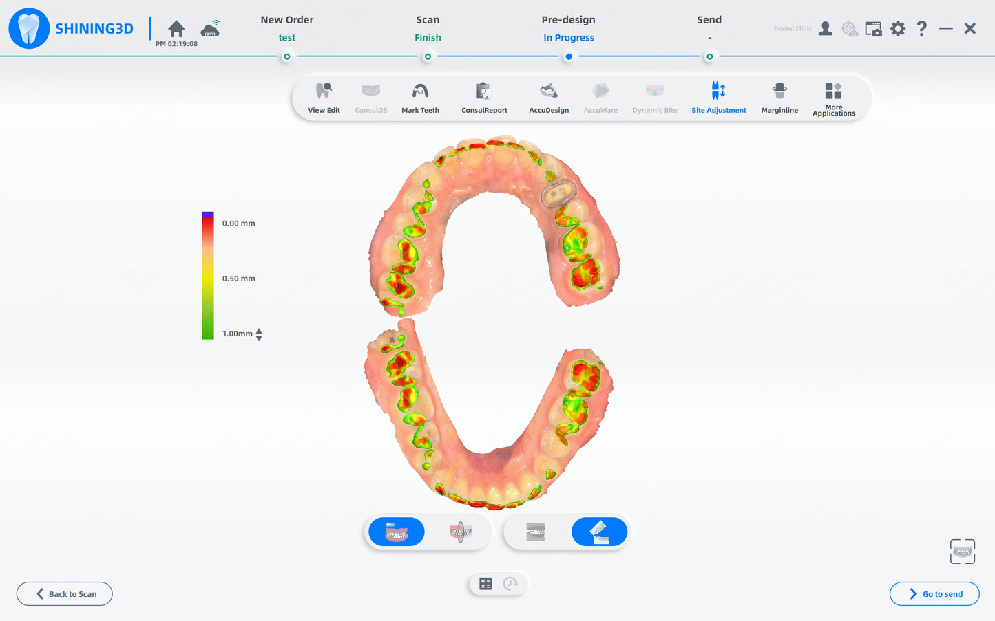 Shining 3D dental AoralScan L