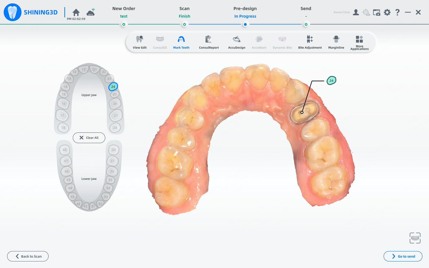 Shining 3D dental AoralScan L