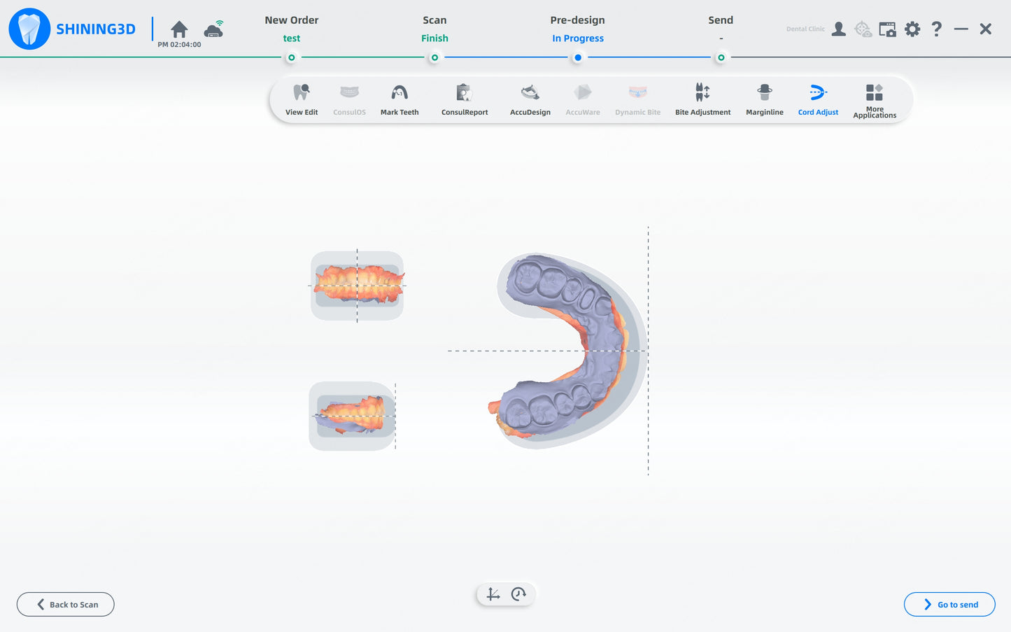 Shining 3D dental AoralScan L